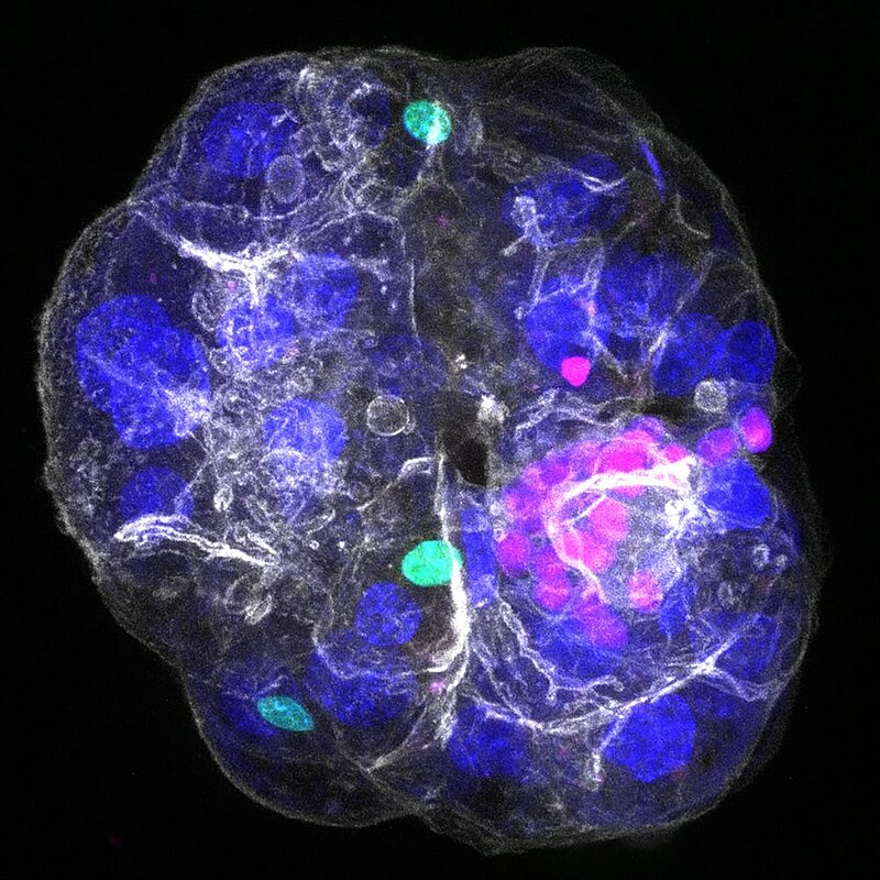 A microscopy image shows a cluster of cells grown in a dish that form a structure called an assembloid. There are dark blue, pink, and green coloured regions marking different cell types. 