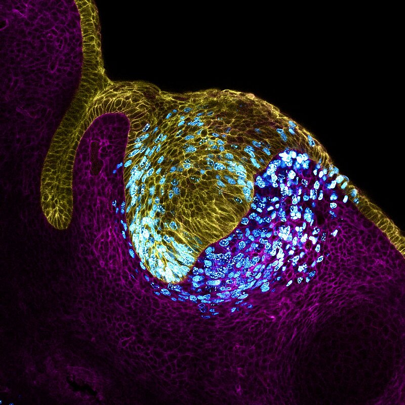 The image depicts a colourful arrangement of cell types, including tooth epithelium marked in yellow, and mesenchymal cells marked in magenta, both on the cell surface. Additionally, proliferating cells marked in cyan are found throughout the image. 
