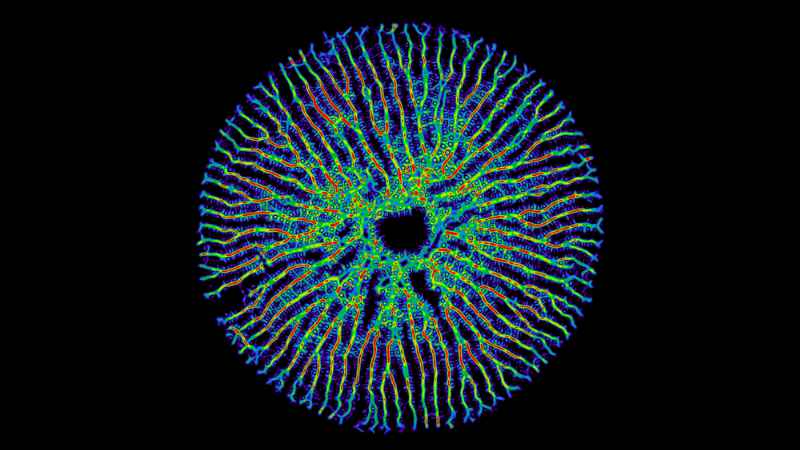 A series of colourful patterns emerge from a single central seed, which is a young diatom valve. These grow outwards and form a halo of branches around the centre